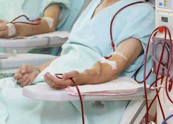 Hemodialysis